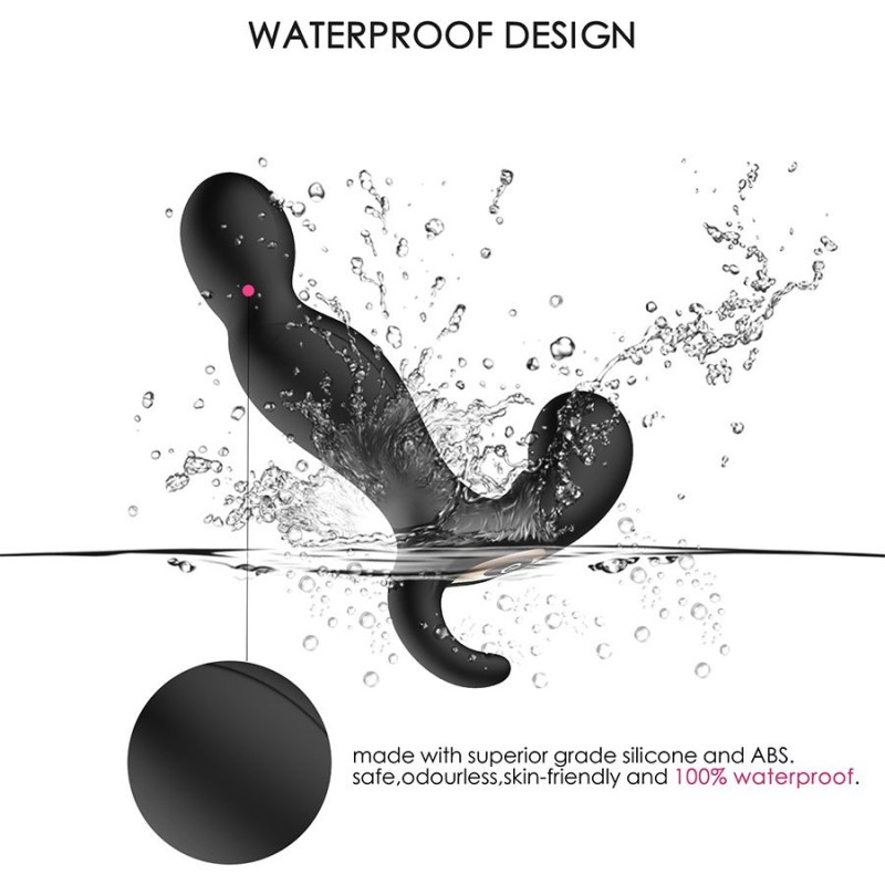 Erocome Orion RC - Prostate Massager