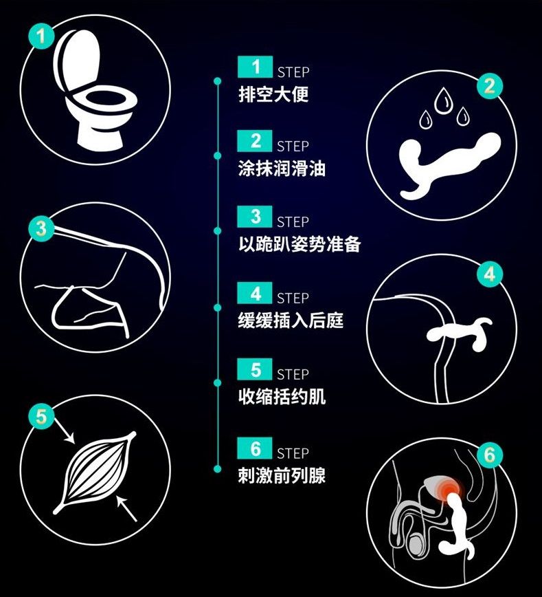 Erocome - Orion RC - Prostate Massager photo-21