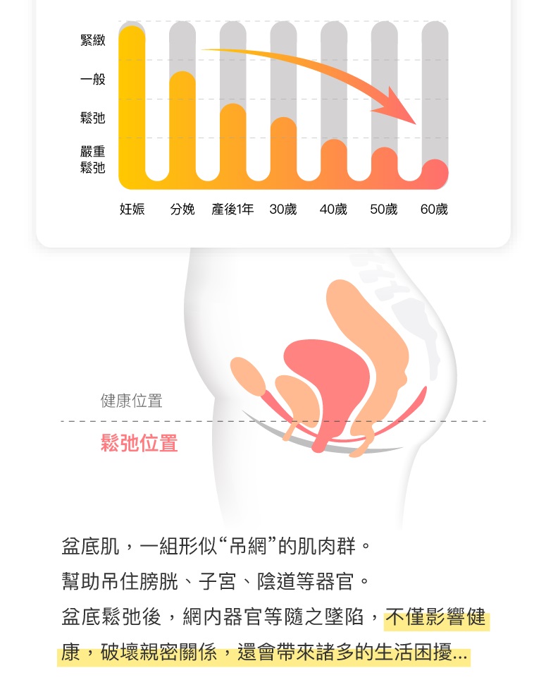 Monster Pub - Lemon Kegel Pro Exerciser - Yellow photo-6